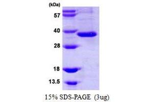 SDS-PAGE (SDS) image for Intelectin 1 (Galactofuranose Binding) (ITLN1) (AA 17-313) protein (ABIN667496) (ITLN1/Omentin Protein (AA 17-313))