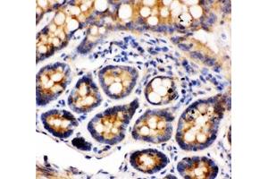 Immunohistochemistry (IHC) image for anti-Integrin alpha 1 (ITGA1) (C-Term) antibody (ABIN3031361)