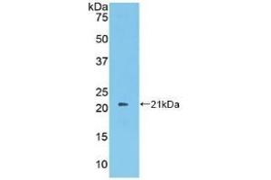 Detection of Recombinant PROS, Human using Polyclonal Antibody to Protein S (PROS) (PROS1 antibody  (AA 481-667))