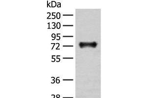Western blot analysis of Mouse brain tissue lysate using KAT14 Polyclonal Antibody at dilution of 1:300 (KAT14 antibody)