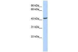 ST3GAL4 antibody used at 1 ug/ml to detect target protein. (ST3GAL4 antibody  (Middle Region))