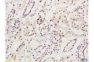 Formalin-fixed and paraffin embedded: rat brain tissue labeled with Anti-MGMT Polyclonal Antibody (ABIN730768), Unconjugated at 1:200, followed by conjugation to the secondary antibody and DAB staining (MGMT antibody  (AA 101-207))