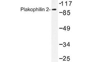 Image no. 1 for anti-Plakophilin 2 (PKP2) antibody (ABIN317928) (Plakophilin 2 antibody)