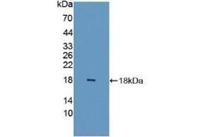 Detection of Recombinant FABP6, Human using Polyclonal Antibody to Fatty Acid Binding Protein 6, Ileal (FABP6)