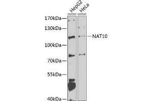 Western blot analysis of extracts of various cell lines, using N antibody (ABIN6132968, ABIN6144376, ABIN6144377 and ABIN6223123) at 1:1000 dilution. (NAT10 antibody  (AA 1-250))