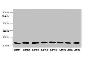 Western blot All lanes: RAB23 antibody at 3. (RAB23 antibody  (AA 1-237))