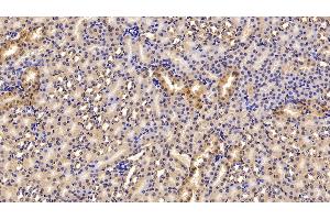 Immunohistochemistry (IHC) image for anti-Fibrinogen beta Chain (FGB) (AA 29-491) antibody (ABIN7438043)