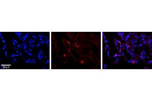 Immunohistochemistry (IHC) image for anti-Presenilin Associated, Rhomboid-Like (PARL) (N-Term) antibody (ABIN2782038)