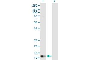 Western Blot analysis of GUCA2B expression in transfected 293T cell line by GUCA2B MaxPab polyclonal antibody. (GUCA2B antibody  (AA 1-112))