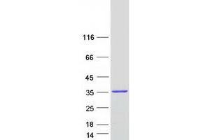 Validation with Western Blot (SPIN3 Protein (Transcript Variant 1) (Myc-DYKDDDDK Tag))