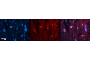 Rabbit Anti-Arih2 Antibody  Catalog Number: ARP57936_P050 Formalin Fixed Paraffin Embedded Tissue: Human Adult heart  Observed Staining: Nuclear Primary Antibody Concentration: 1:100 Secondary Antibody: Donkey anti-Rabbit-Cy2/3 Secondary Antibody Concentration: 1:200 Magnification: 20X Exposure Time: 0. (ARIH2 antibody  (C-Term))