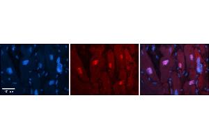 Rabbit Anti-Arih2 Antibody  Catalog Number: ARP57936_P050 Formalin Fixed Paraffin Embedded Tissue: Human Adult heart  Observed Staining: Nuclear Primary Antibody Concentration: 1:100 Secondary Antibody: Donkey anti-Rabbit-Cy2/3 Secondary Antibody Concentration: 1:200 Magnification: 20X Exposure Time: 0.