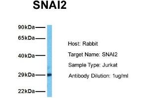 Host: Rabbit Target Name: SNAI2 Sample Tissue: Human Jurkat Antibody Dilution: 1. (SLUG antibody  (Middle Region))