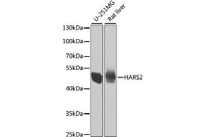 Western blot analysis of extracts of various cell lines, using HARS2 antibody. (HARS2 antibody)