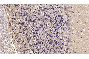 Detection of SEMA5B in Human Cerebellum Tissue using Monoclonal Antibody to Semaphorin 5B (SEMA5B) (SEMA5B antibody  (AA 36-602))