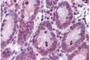 Human Small Intestine: Formalin-Fixed, Paraffin-Embedded (FFPE) (RPL39L antibody  (AA 1-52))