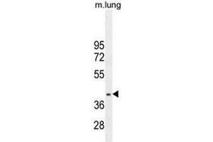 RNF215 Antibody (C-term) western blot analysis in mouse lung tissue lysates (35µg/lane). (RNF215 antibody  (C-Term))