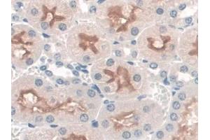 Immunohistochemistry (IHC) image for anti-Syntrophin, beta 1 (Dystrophin-Associated Protein A1, 59kDa, Basic Component 1) (SNTB1) (AA 2-297) antibody (ABIN7444250)