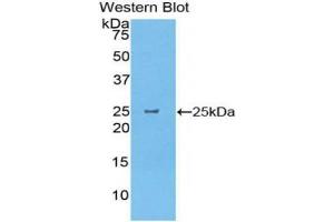 Western blot analysis of the recombinant protein. (CELA1 antibody  (AA 44-259))