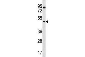 PTEN antibody western blot analysis in K562 lysate. (PTEN antibody  (AA 306-335))