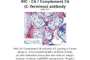 Image no. 1 for anti-Complement Component 6 (C6) antibody (ABIN1723410) (C6 antibody)