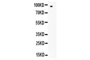 Western Blotting (WB) image for anti-Selectin L (SELL) (AA 39-151) antibody (ABIN5518954)