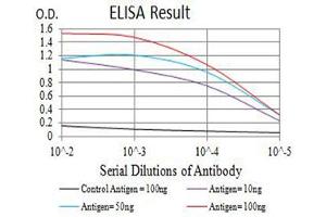 Black line: Control Antigen (100 ng),Purple line: Antigen (10 ng), Blue line: Antigen (50 ng), Red line:Antigen (100 ng) (BCR antibody  (AA 139-280))
