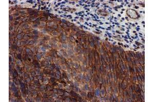 Image no. 2 for anti-Makorin Ring Finger Protein 1 (MKRN1) antibody (ABIN1499486) (MKRN1 antibody)