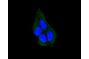 Immunofluorescence analysis of HeLa cells using ARRB1 antibody (ABIN5996907). (beta Arrestin 1 antibody)