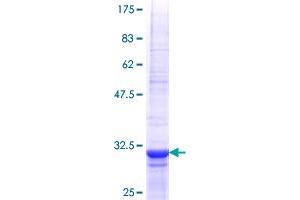 TLL1 Protein (AA 77-150) (GST tag)