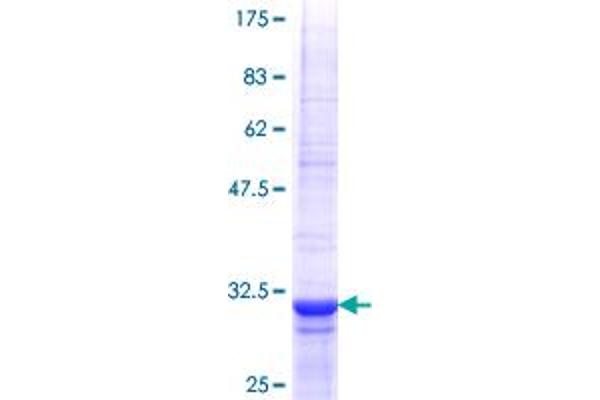 TLL1 Protein (AA 77-150) (GST tag)