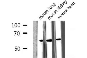 Western blot analysis of Phospho-Src (Tyr418) expression in various lysates (Src antibody  (pTyr419))