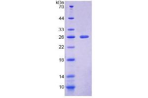 SDS-PAGE (SDS) image for Natural Cytotoxicity Triggering Receptor 1 (NCR1) (AA 17-211) protein (His tag) (ABIN6239045)