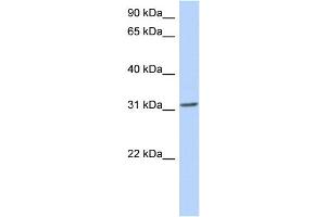 WB Suggested Anti-GSC Antibody Titration: 0. (GSC antibody  (N-Term))