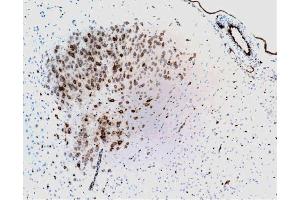 Immunohistochemical staining of neurons and endothelial cells from blood vessels (formalin-fixed, citrate buffer pre-treatment, 10X). (PTGS2 antibody  (AA 368-604))