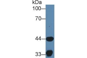 Western Blotting (WB) image for anti-Hydroxyacyl-CoA Dehydrogenase (HADH) (AA 1-236) antibody (ABIN7445138)