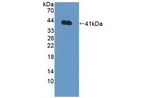 Detection of Recombinant FNTa, Human using Polyclonal Antibody to Farnesyltransferase Alpha (FNTa) (FNTA antibody  (AA 51-366))