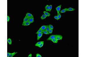 Immunofluorescent analysis of HepG2 cells using ABIN7152495 at dilution of 1:100 and Alexa Fluor 488-congugated AffiniPure Goat Anti-Rabbit IgG(H+L) (BTRC antibody  (AA 397-448))