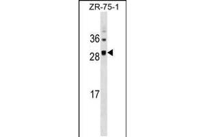 Western blot analysis in ZR-75-1 cell line lysates (35ug/lane). (SPC25 antibody  (AA 87-114))