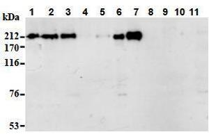 Western Blotting (WB) image for anti-Apoptotic Chromatin Condensation Inducer 1 (ACIN1) (AA 1-523), (N-Term) antibody (ABIN1105223) (ACIN1 antibody  (N-Term))