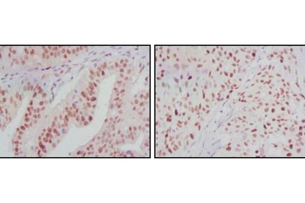 ATP2C1 antibody