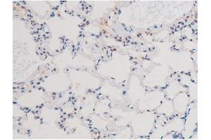 Immunohistochemistry (IHC) image for anti-Insulin Receptor Substrate 1 (IRS1) (pSer636) antibody (ABIN6255436)