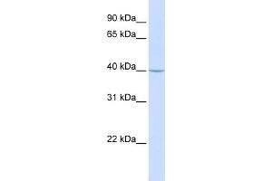 WB Suggested Anti-TRAM2 Antibody Titration:  0. (TRAM2 antibody  (N-Term))