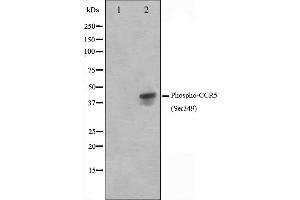 Western blot analysis on Jurkat cell lysate using Phospho-CCR5(Ser349) Antibody. (CCR5 antibody  (pSer349))