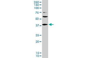 LHX6 monoclonal antibody (M01), clone 3D9. (LHX6 antibody  (AA 274-363))