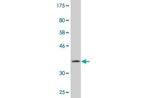 Western Blot detection against Immunogen (37. (NR0B1 antibody  (AA 361-470))