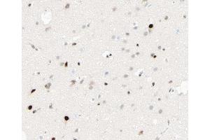 ABIN6267413 at 1/100 staining human brain tissue sections by IHC-P. (CEBPB antibody  (pThr235))