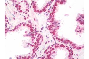Anti-NELFA / WHSC2 antibody IHC staining of human prostate. (WHSC2 antibody  (AA 280-511))