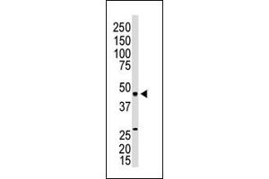 The anti-EDG3 N-term Antibody (ABIN390084 and ABIN2840603) is used in Western blot to detect EDG3 in mouse kidney lysate. (S1PR3 antibody  (N-Term))