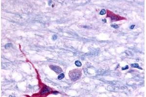 GPR101 antibody  (Cytoplasmic Domain)